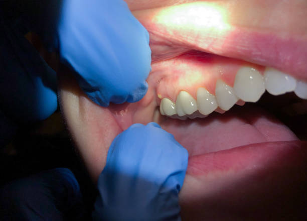 , MA Emergency Dentist Company